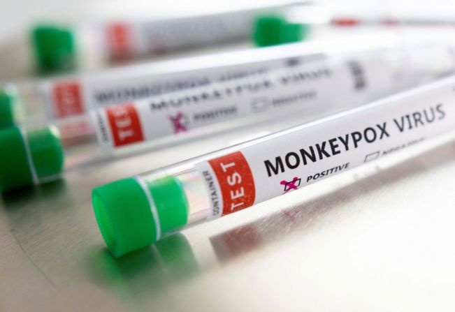 Ministério da Saúde confirma 8° caso de varíola dos macacos no Brasil